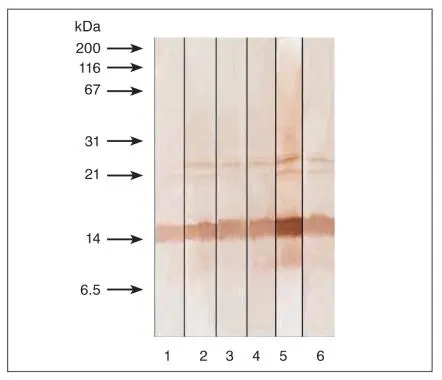 Detection of human recombinant PCT in Western blotting by monoclonal antibodies specific to calcitonin following 15% SDS-PAGE in reducing conditions.